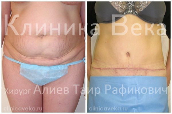 Детские поликлиника кировский район