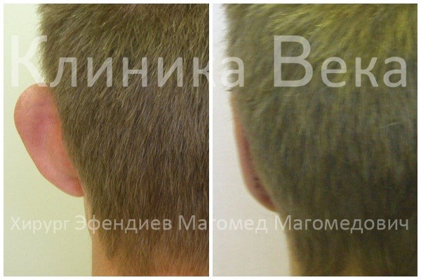 Маленькие бедра большая грудь платья