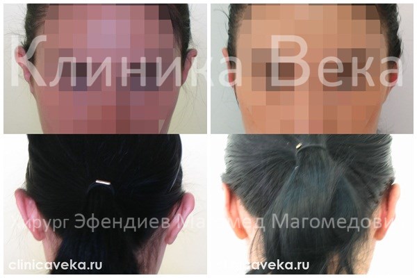 Свадьбы звёзд дагестана Свадьбы звёзд дагестана