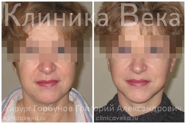 Payday 2 Как получить маски? Что означает тату самолёта