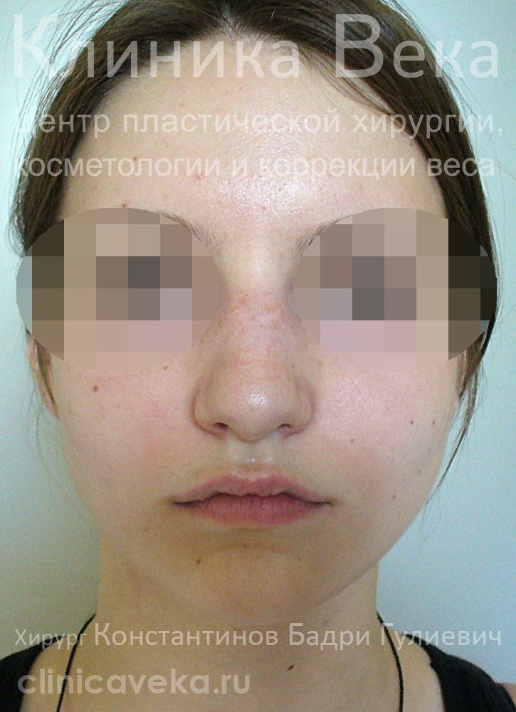 У моей девушки маленькие соски и большая грудь